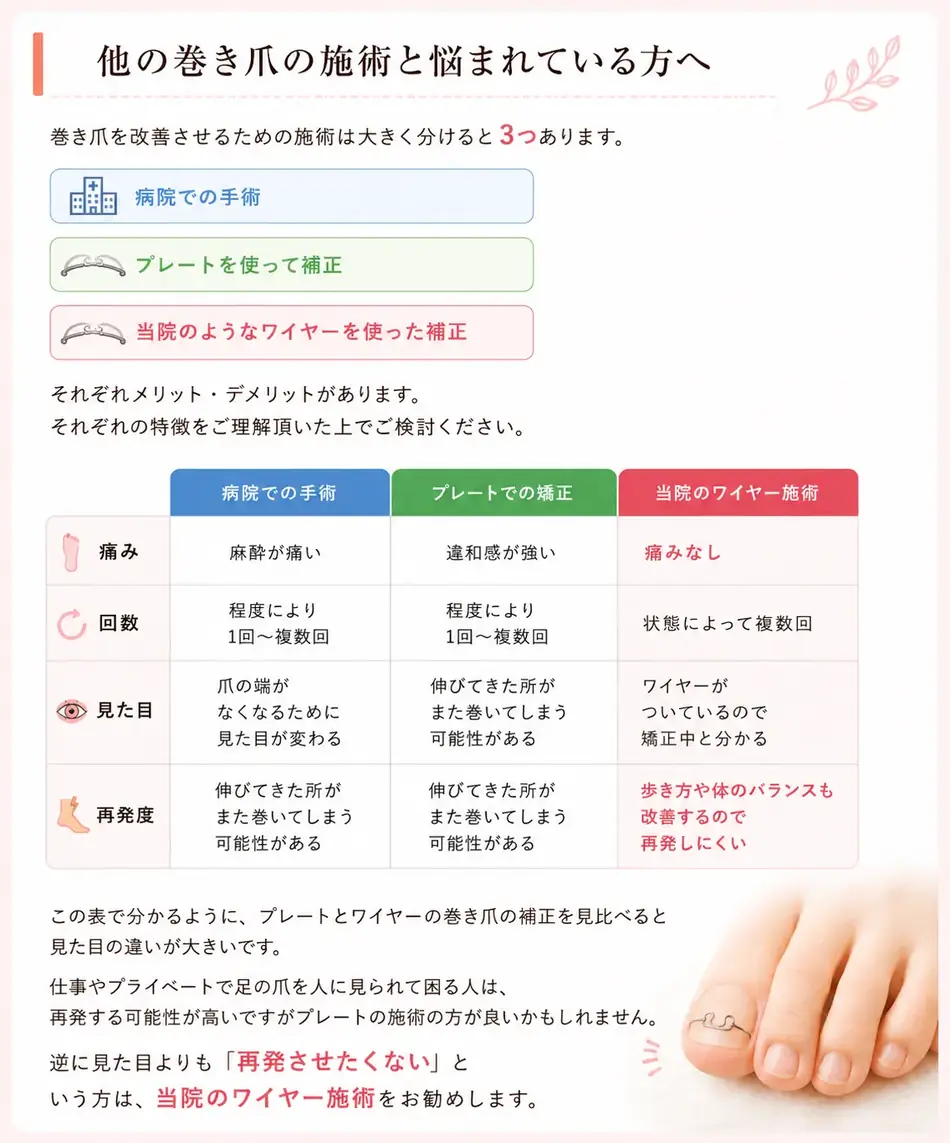 他の巻き爪の施術と悩まれている方へ。施術は大きく分けて3つ：病院での手術／プレートを使って補正／当院のようなワイヤーを使った補正。痛み・回数・見た目・再発度の比較表。当院のワイヤー施術は痛みなしで再発しにくい。